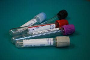 Blood Test Vials