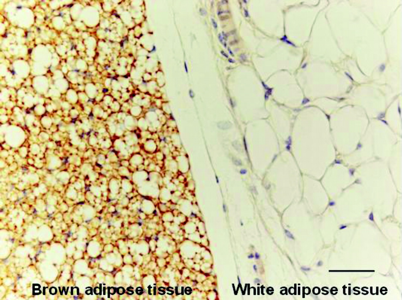 Brown Adipose Tissue vs White Adipose Tissue