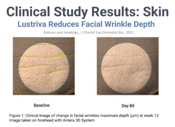 Lustriva: Next-Generation Beaty-From-Within Supplement from Nutrition21