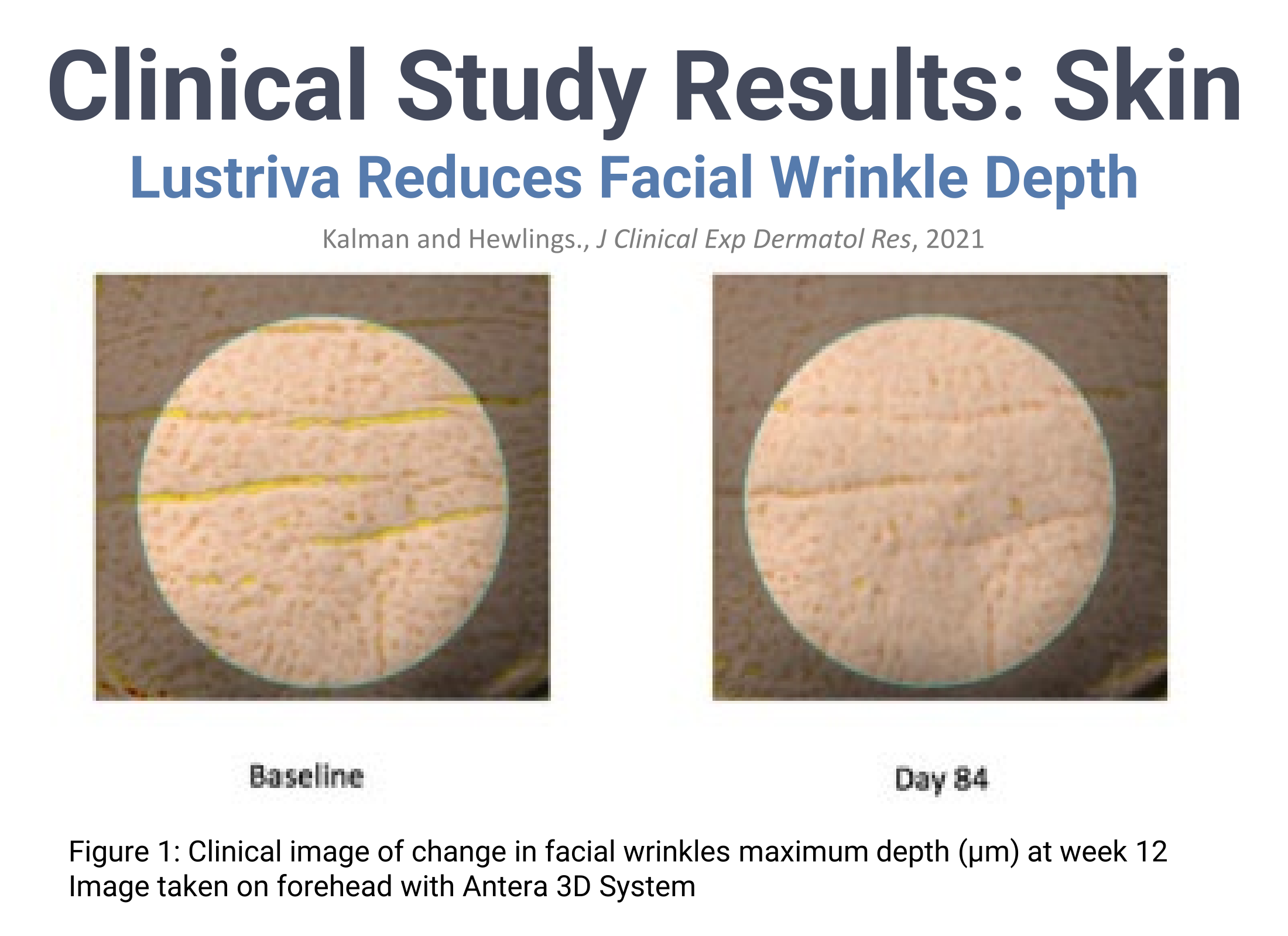 Lustriva Study Skin Results