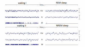 Mouse EEG