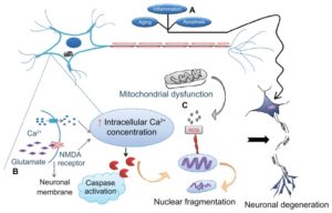 Neurodegeneration Causes