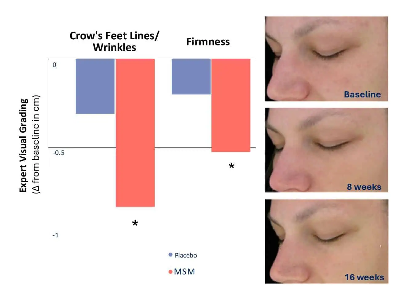 OptiMSM 16 Week Wrinkle Image Analysis Study Results