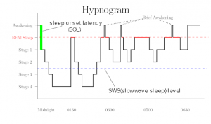 Sleep Hypnogram